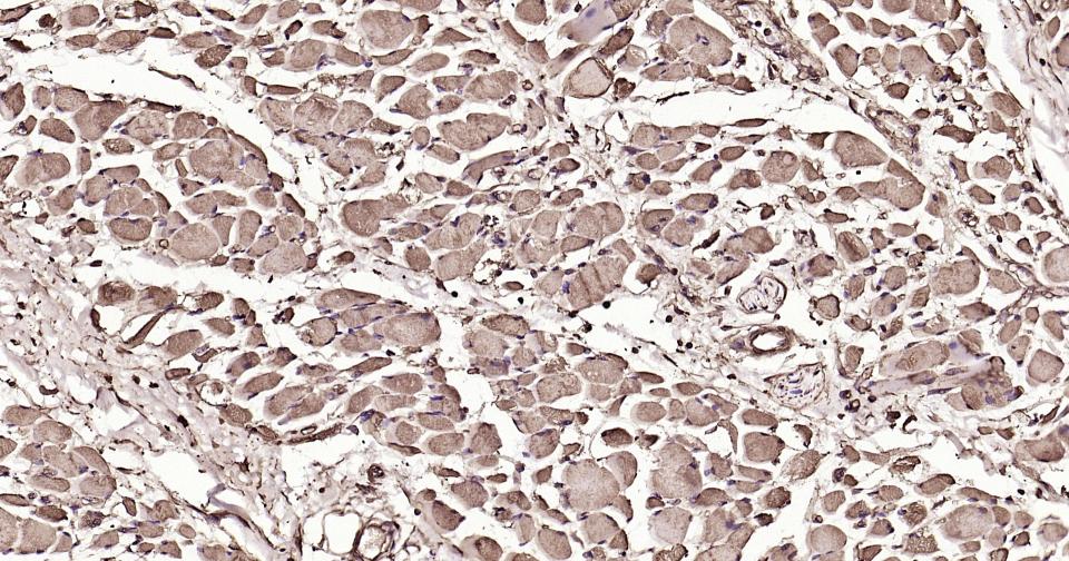 钙调节素重组兔单抗