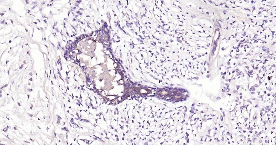 细胞凋亡信号调节激酶1重组兔单抗