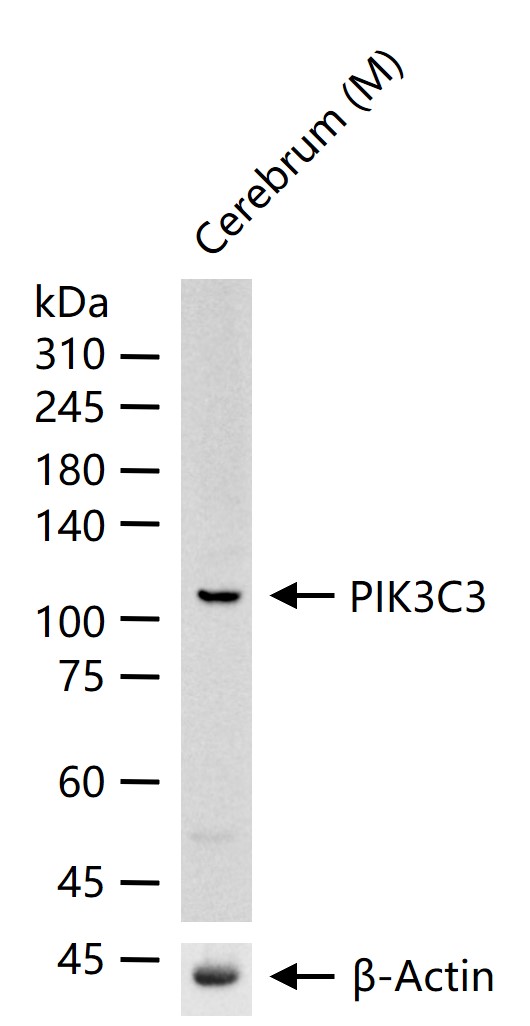 磷脂酰肌醇激酶3催化亚单位3重组兔单抗