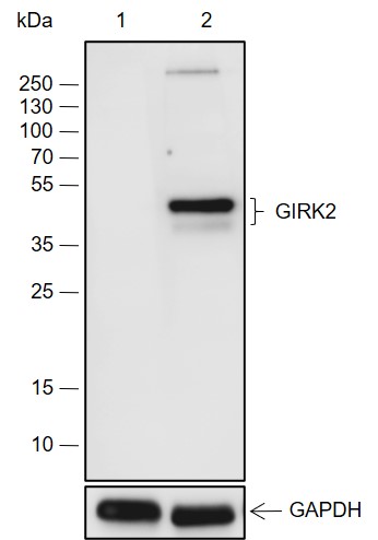 KCNJ6 Recombinant Rabbit mAb (一抗) | Bioss