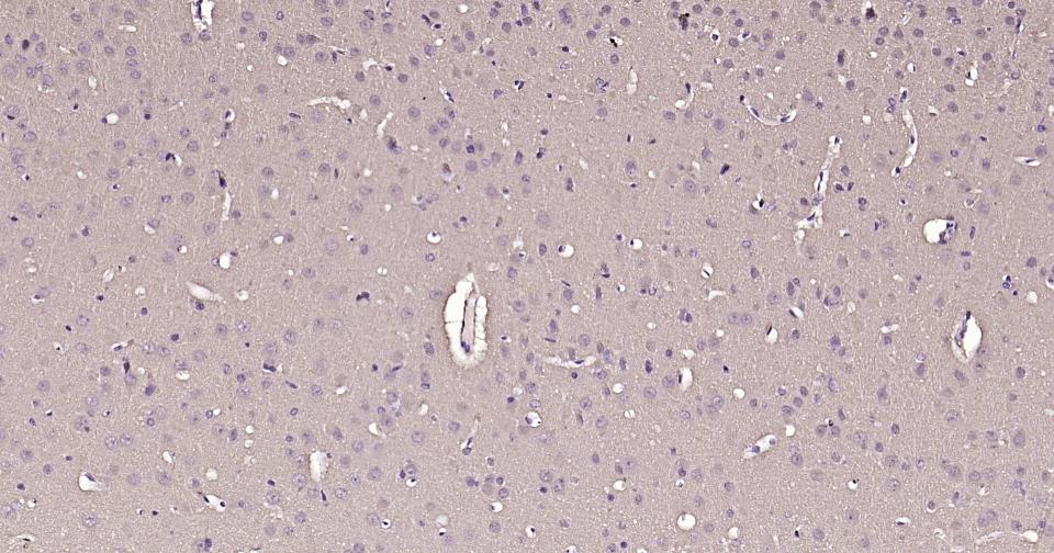 钙调节素重组兔单抗