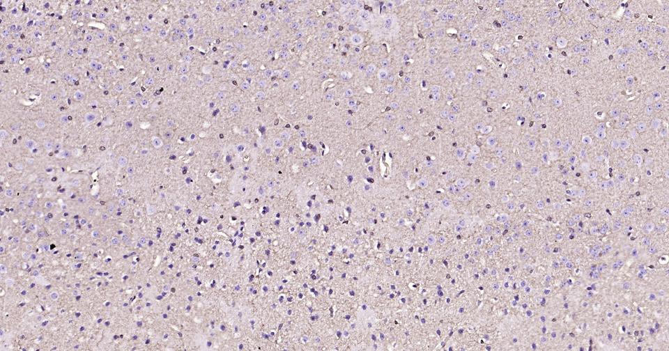 谷氨酰胺合成酶/谷氨酸氨连接酶重组兔单抗