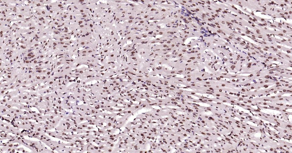 转录因子E2F-1重组兔单抗