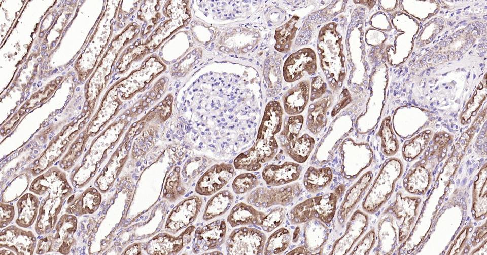 胱抑素C/半胱氨酸蛋白酶抑制剂C重组兔单抗