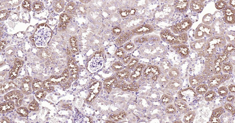 胱抑素C/半胱氨酸蛋白酶抑制剂C重组兔单抗