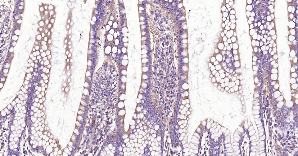 死亡相关蛋白激酶1重组兔单抗