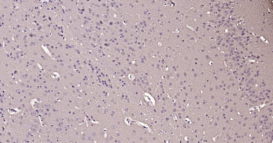 钙调节素重组兔单抗