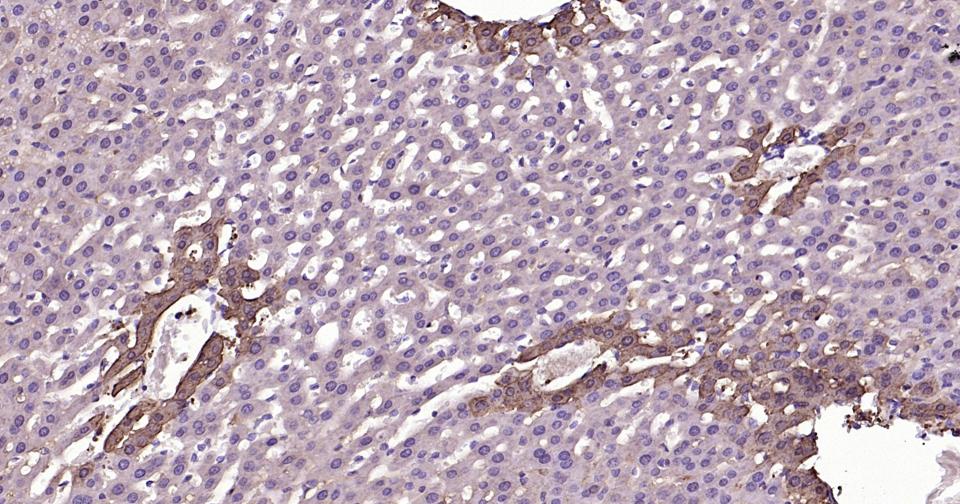 谷氨酰胺合成酶/谷氨酸氨连接酶重组兔单抗