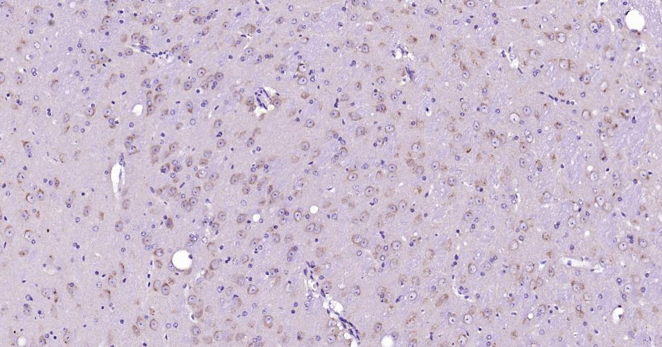 细胞凋亡信号调节激酶1重组兔单抗
