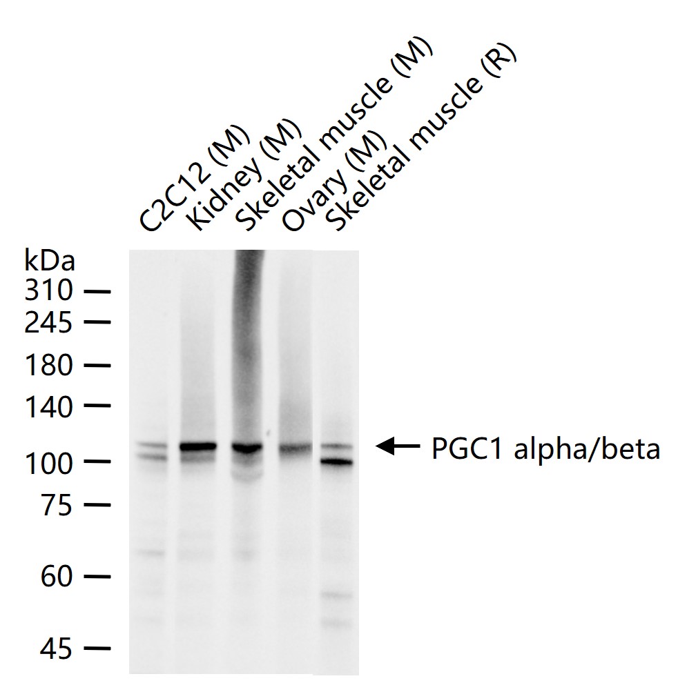 过氧化物酶体增殖物激活受体γ辅激活子1α/β重组兔单抗