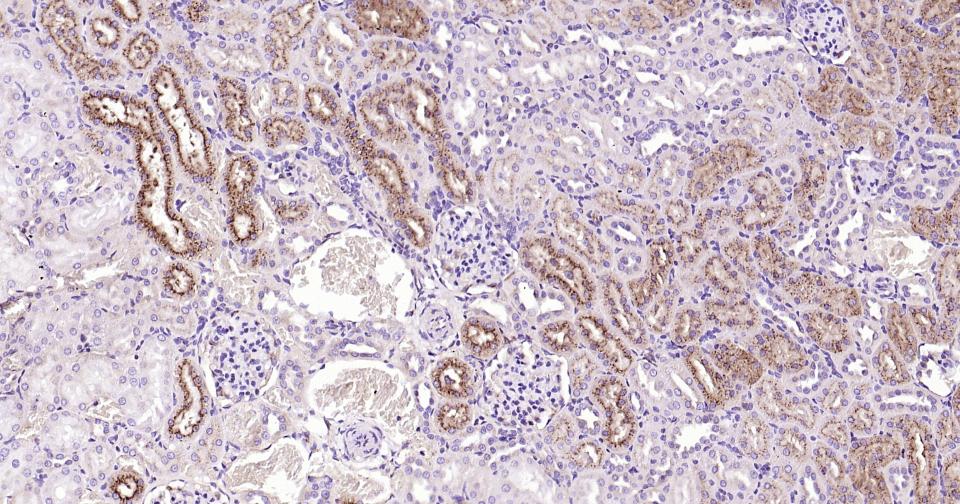 胱抑素C/半胱氨酸蛋白酶抑制剂C重组兔单抗