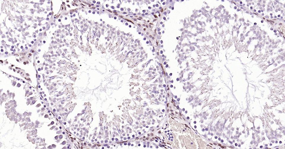 转录因子E2F-1重组兔单抗