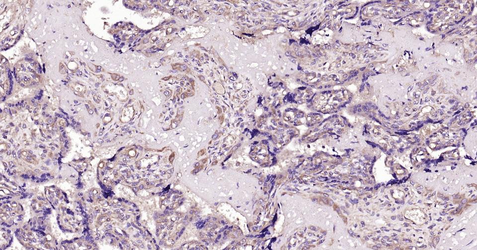 死亡相关蛋白激酶1重组兔单抗