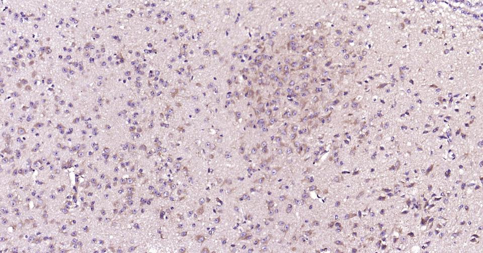 死亡相关蛋白激酶1重组兔单抗