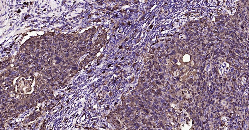 S100钙结合蛋白A8重组兔单抗