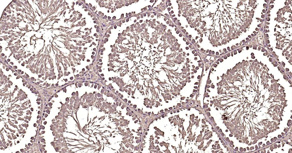 钙调节素重组兔单抗