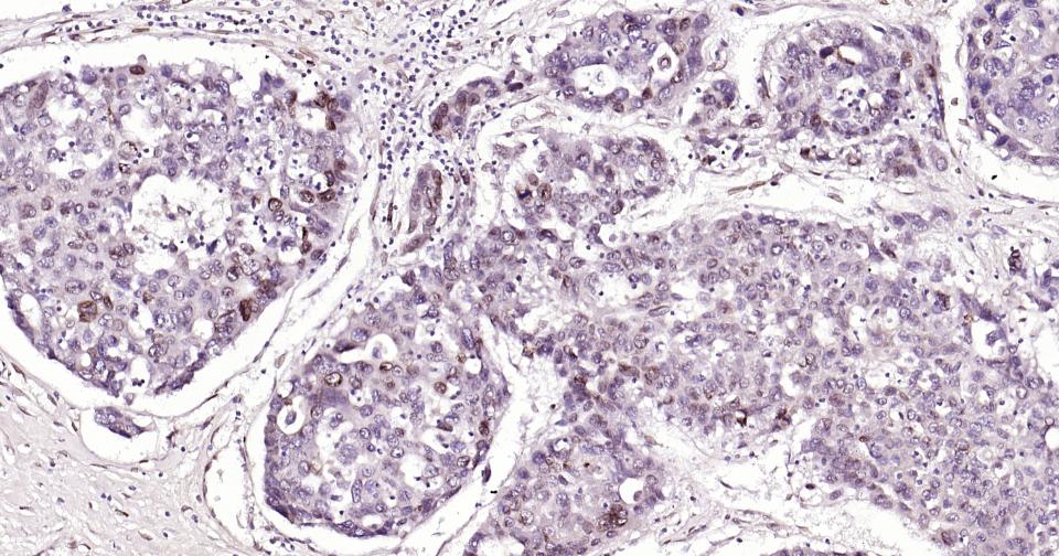 转录因子E2F-1重组兔单抗