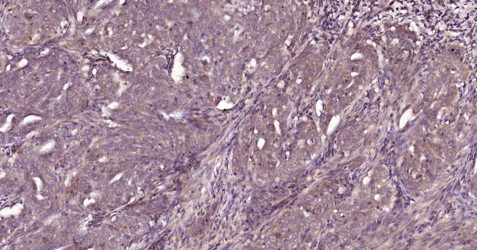 细胞凋亡信号调节激酶1重组兔单抗