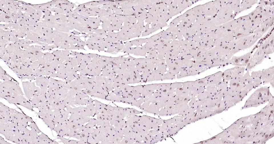 转录因子E2F-1重组兔单抗