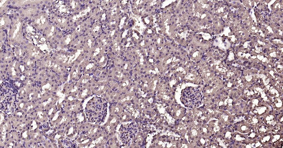 钙调节素重组兔单抗