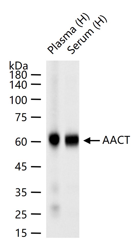 α-1抗胰糜蛋白酶/SERPINA3重组兔单克隆抗体