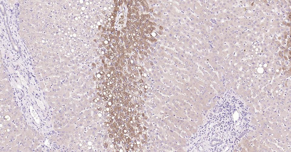 谷氨酰胺合成酶/谷氨酸氨连接酶重组兔单抗