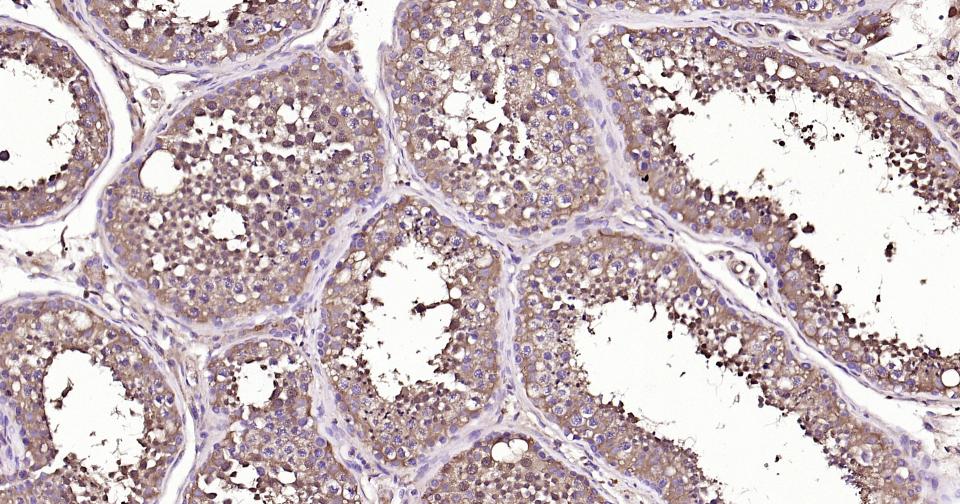 胱抑素C/半胱氨酸蛋白酶抑制剂C重组兔单抗