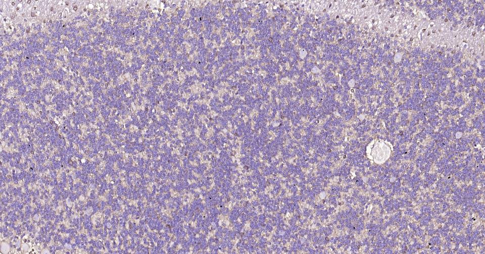 谷氨酰胺合成酶/谷氨酸氨连接酶重组兔单抗