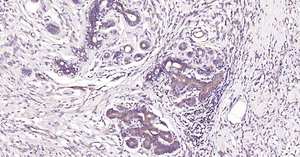 死亡相关蛋白激酶1重组兔单抗