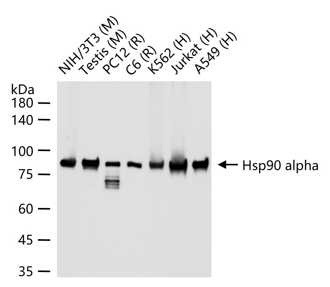 热休克蛋白90α重组兔单抗