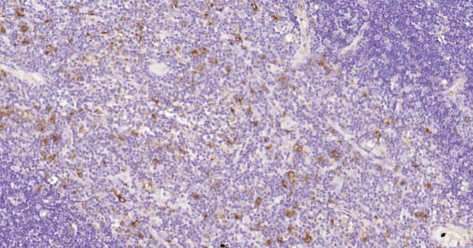 胱抑素C/半胱氨酸蛋白酶抑制剂C重组兔单抗