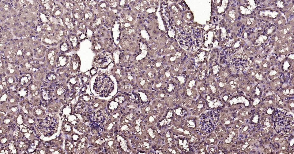 钙调节素重组兔单抗