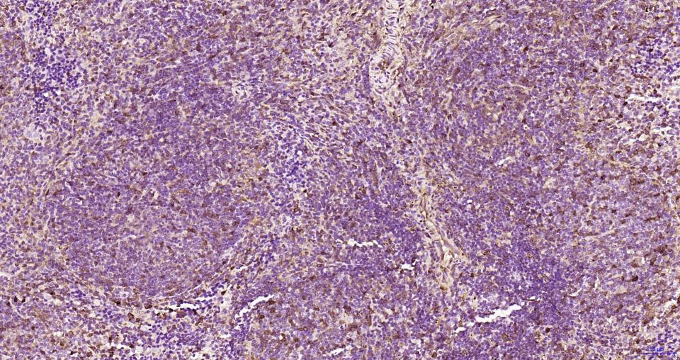 S100钙结合蛋白A6重组兔单抗