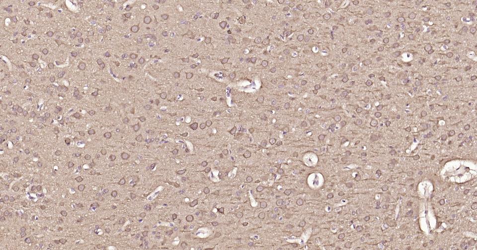 自噬微管相关蛋白轻链3重组兔单抗
