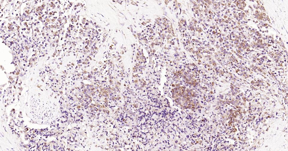 磷脂酰肌醇激酶3催化亚单位3重组兔单抗