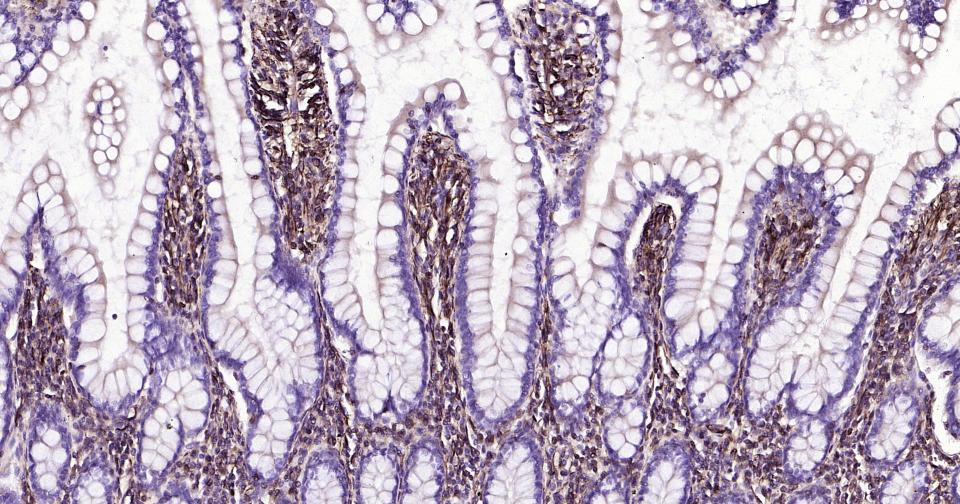 波形蛋白抗体-bs-0756R