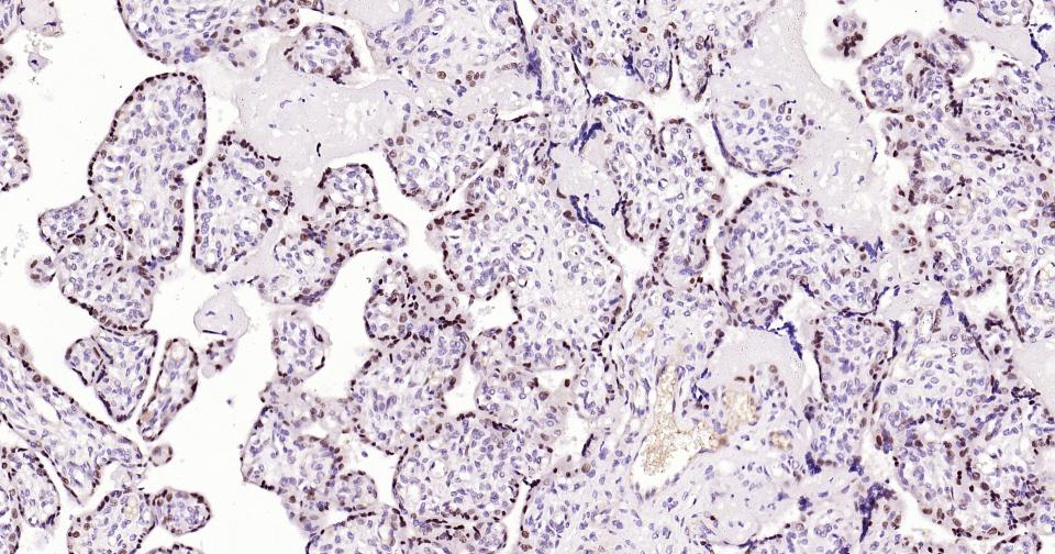 DNA甲基转移酶-3α重组兔单抗