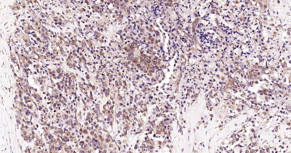 干细胞生长因子重组兔单抗