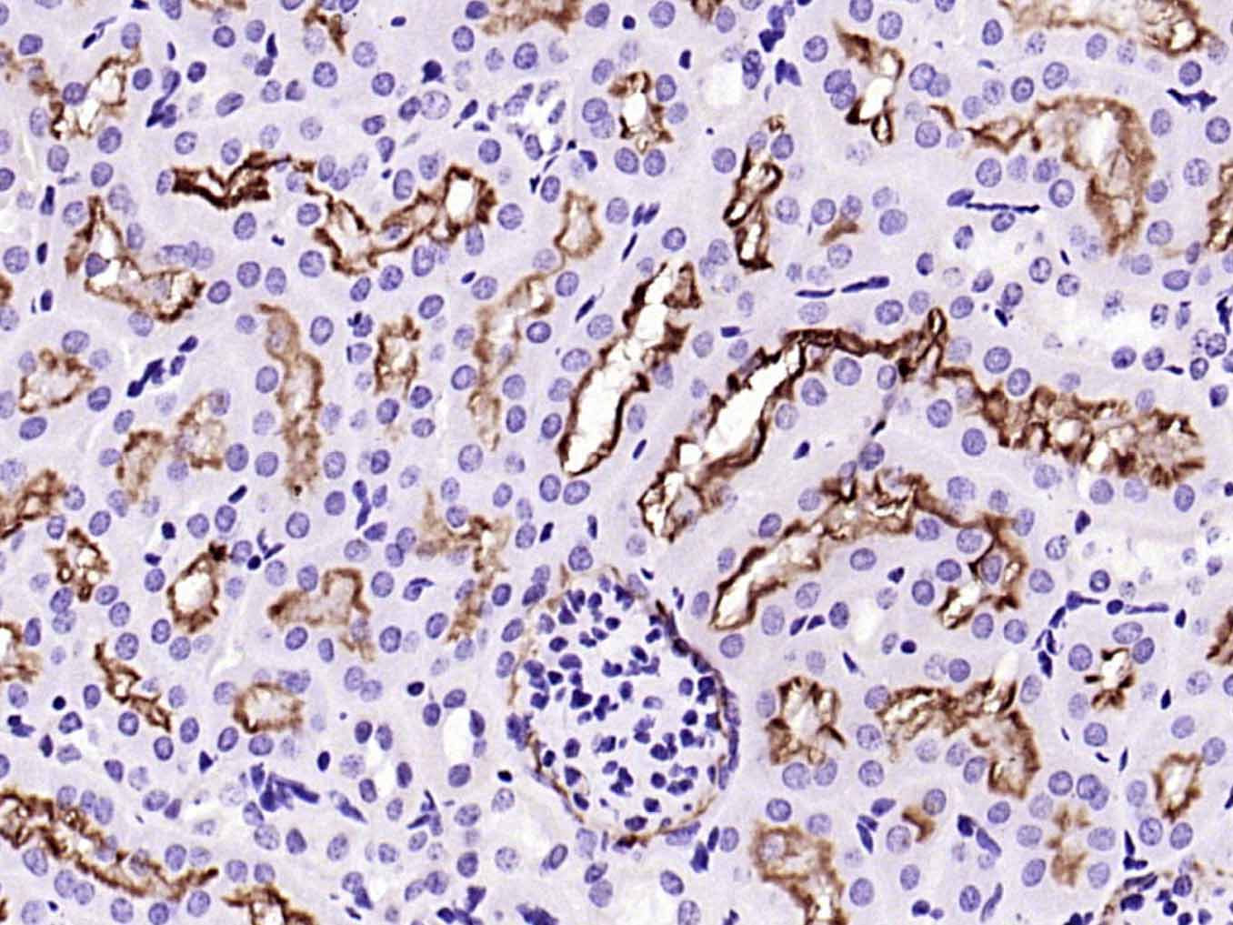 血管紧张素转换酶重组兔单抗