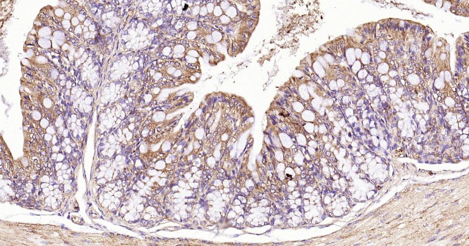 凋亡蛋白活性因子-1重组兔单抗