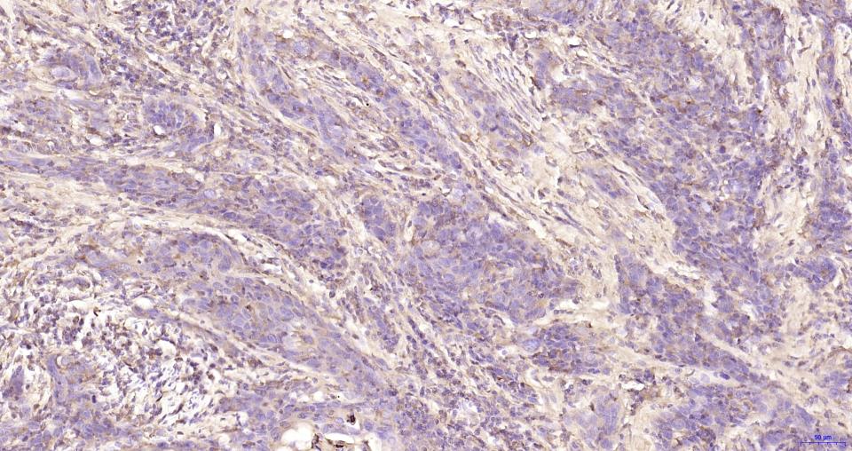α-1抗胰糜蛋白酶/SERPINA3重组兔单克隆抗体
