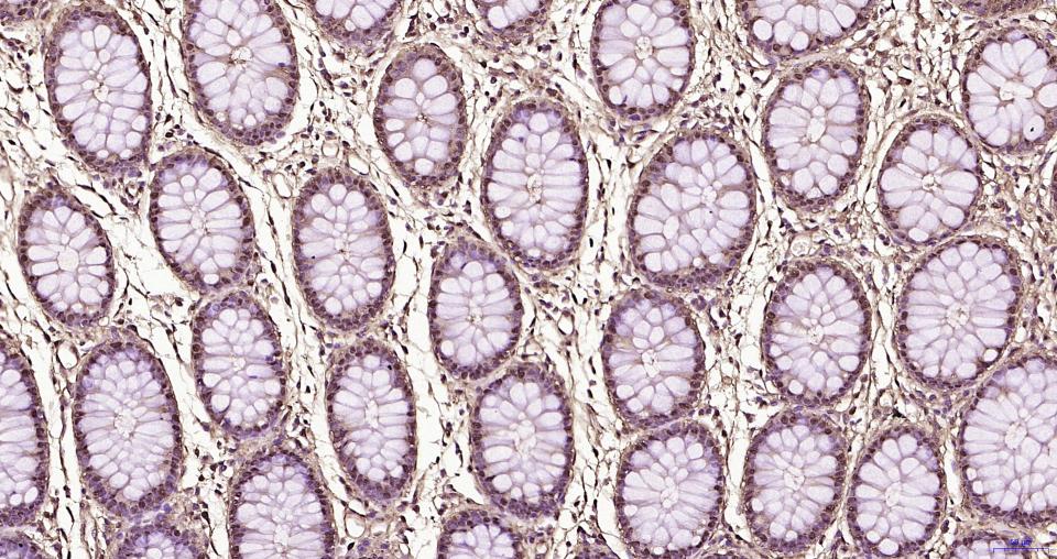 S100钙结合蛋白A6重组兔单抗