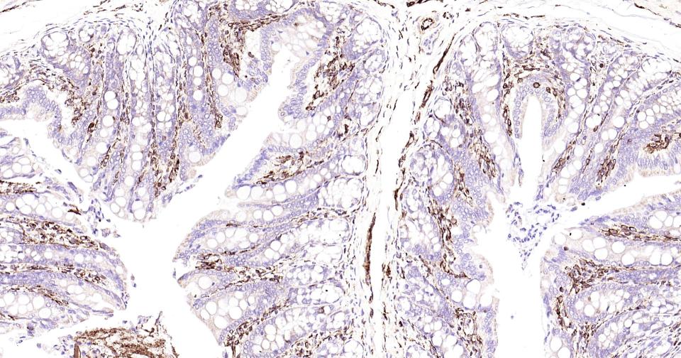 波形蛋白抗体-bs-0756R