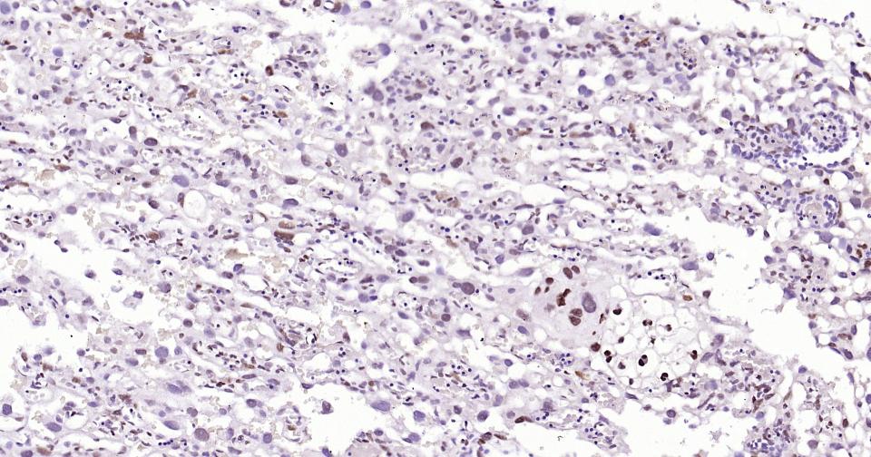 DNA甲基转移酶-3α重组兔单抗