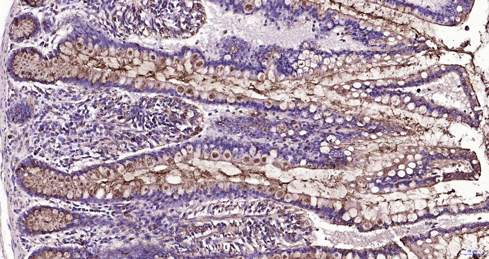 溶酶体相关膜蛋白1(CD107)重组兔单抗