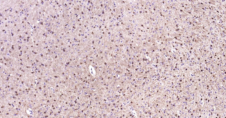 离子型谷氨酸受体1重组兔单抗