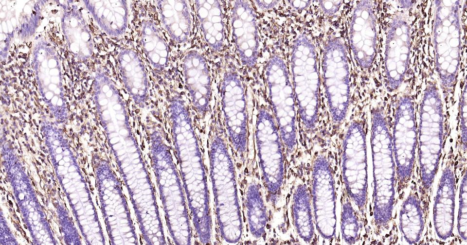 波形蛋白抗体-bs-23063R