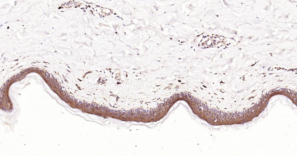 凋亡蛋白活性因子-1重组兔单抗