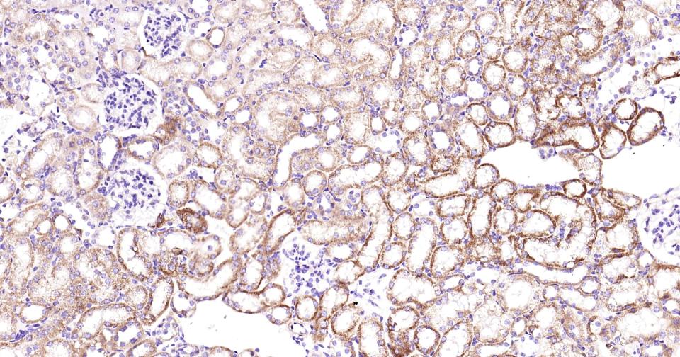磷脂酰肌醇激酶3催化亚单位3重组兔单抗