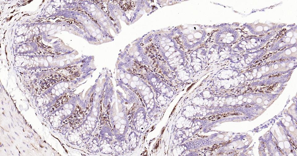 波形蛋白抗体-bs-8533R